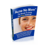 Can You Cure Acne Naturally'